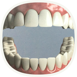Implantat - bei einem fehlenden Zahn - nach